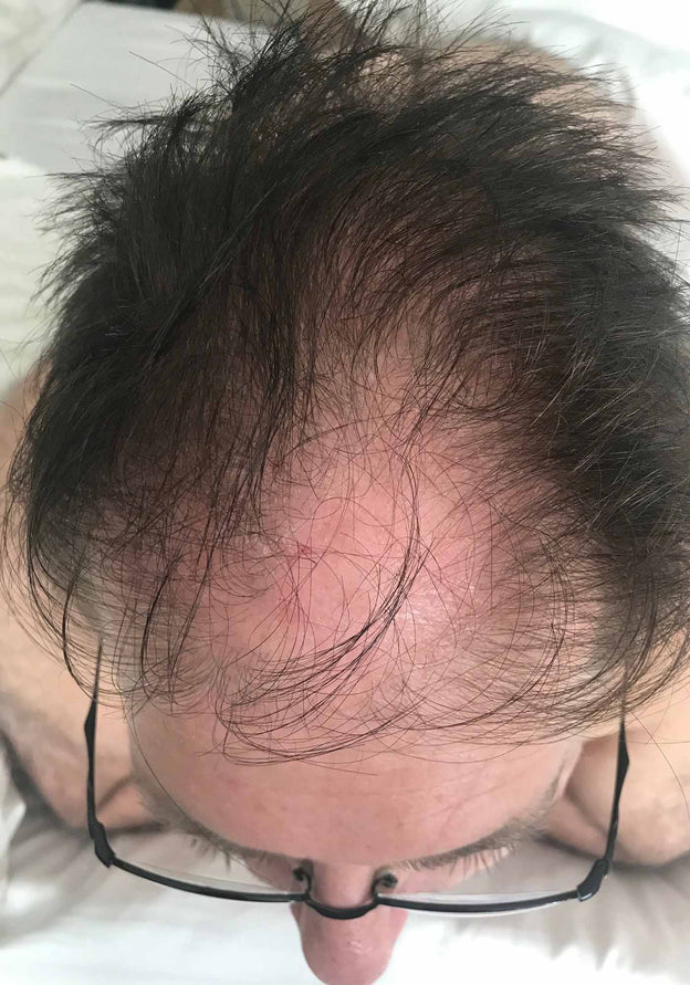 Before - Gary